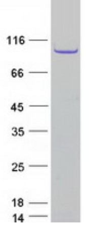 SDS-PAGE (TPX2-1921H).jpg